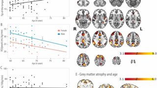 高齢になっても健康でいることは、適切な言葉を見つけるのに役立つ脳領域をサポートする(Being fit in older age supports brain regions that help you reach for right words)