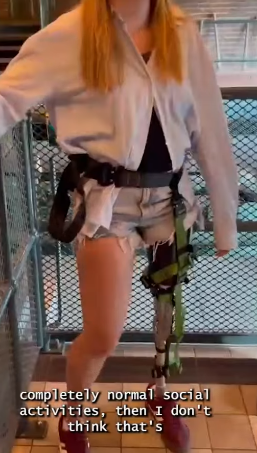 義足使用者向けの安全ストラップを開発(Innovative safety strap gives prosthesis users access to roller coasters again)