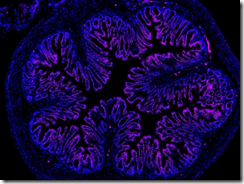 腸内痛に対するナノ粒子治療と新酵素の発見(Microbiome and Nanoparticle Discoveries Hold Promise for Treating Gut Pain)