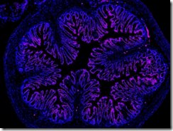 腸内痛に対するナノ粒子治療と新酵素の発見(Microbiome and Nanoparticle Discoveries Hold Promise for Treating Gut Pain)