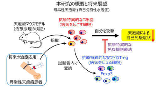 病気を「起こす細胞」を「抑える細胞」に変換して、抗原特異的に治療～iTreg (誘導型制御性T細胞) による新しい免疫細胞療法で難治性の自己免疫疾患・尋常性天疱瘡の治療に挑む～