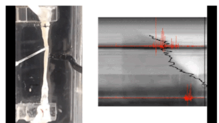 電気パルスで腸の動きを促進()