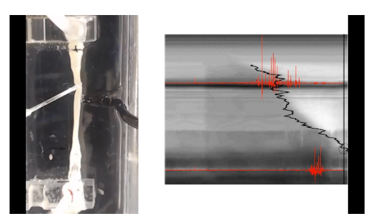 電気パルスで腸の動きを促進(Using Electrical Bursts to Get the Gut Moving)