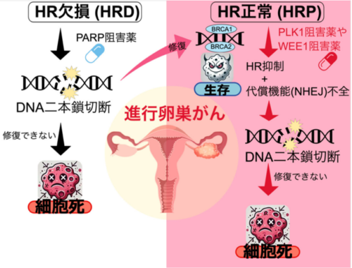 “治療抵抗性”とされてきたBRCA野生型卵巣がんに 有効な治療標的を発見