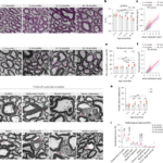 加齢に伴い脊髄を保護する免疫細胞の役割を発見(As we age, immune cells protect the spinal cord)