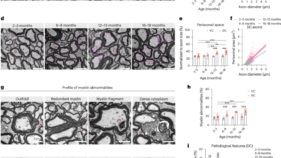 加齢に伴い脊髄を保護する免疫細胞の役割を発見(As we age, immune cells protect the spinal cord)