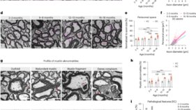 加齢に伴い脊髄を保護する免疫細胞の役割を発見(As we age, immune cells protect the spinal cord)
