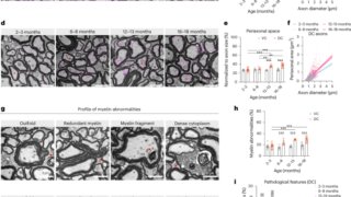 加齢に伴い脊髄を保護する免疫細胞の役割を発見(As we age, immune cells protect the spinal cord)