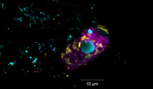 共生細菌が廃水浄化を支援 ― 新種の脱窒内共生細菌を同定 (Symbiotic bacteria help clean wastewater)