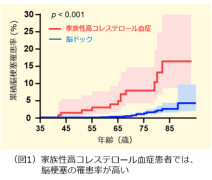 日本人の家族性高コレステロール血症が、脳梗塞のリスクに～アジアでの国際共同研究構築への基盤データに～