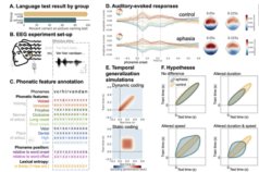 脳卒中後に言語理解が障害される仕組みを解明(Why the brain misunderstands speech after stroke)