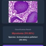 AIによる皮膚疾患診断技術の開発(Identifying Skin Disease with AI) AIによる皮膚疾患診断技術の開発(Identifying Skin Disease with AI)