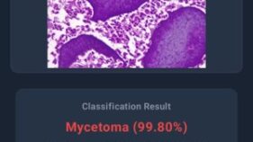 AIによる皮膚疾患診断技術の開発(Identifying Skin Disease with AI)