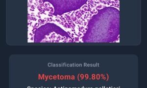 AIによる皮膚疾患診断技術の開発(Identifying Skin Disease with AI)