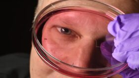 培養網膜がヒトの高精細視覚進化を示唆(Lab-grown Retinas May Show How Humans Developed Sharp Vision)