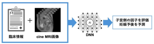妊娠に向けた子宮機能の評価モデルを人工知能で開発―cine MRIを活用した着床不全における子宮蠕動運動の解析―