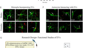 老化脳の炎症を抑制し記憶を回復する新療法（New therapy is turning back the clock in aging brains）
