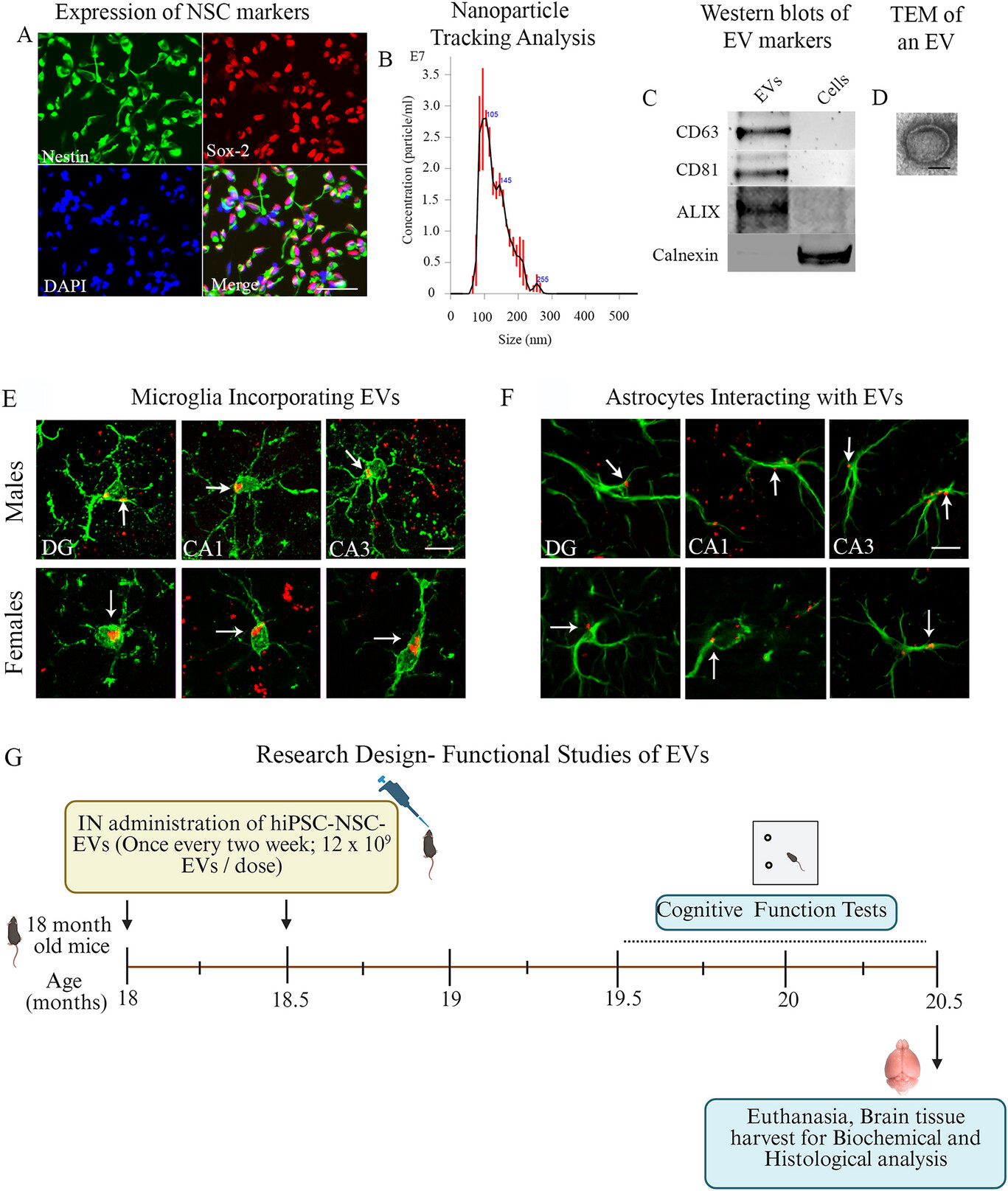 老化脳の炎症を抑制し記憶を回復する新療法（New therapy is turning back the clock in aging brains）