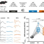 騒音による脳損傷からの回復メカニズムを解明(Neurophysiology: How the brain recovers from noise-induced damage) 騒音による脳損傷からの回復メカニズムを解明(Neurophysiology: How the brain recovers from noise-induced damage)
