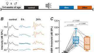 騒音による脳損傷からの回復メカニズムを解明（Neurophysiology: How the brain recovers from noise-induced damage）