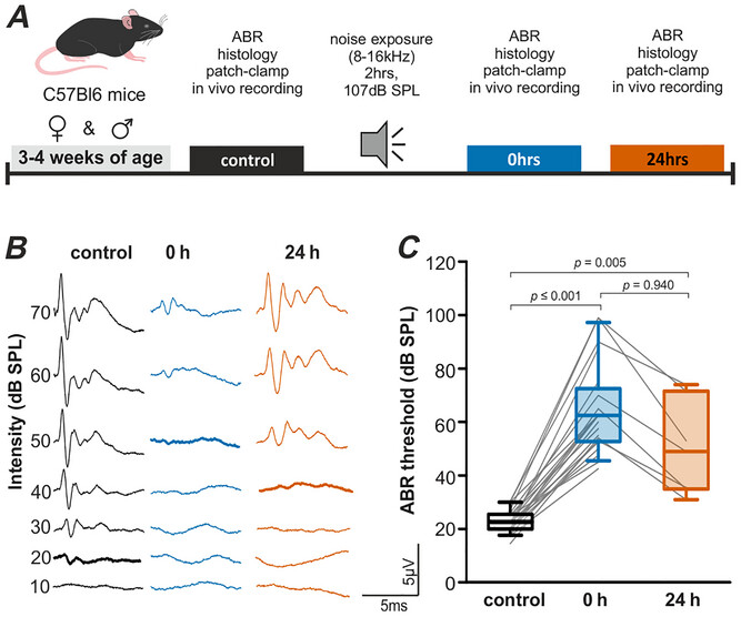 騒音による脳損傷からの回復メカニズムを解明（Neurophysiology: How the brain recovers from noise-induced damage）