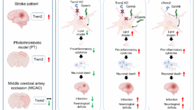 動物モデル選択の教訓：脳卒中後の神経炎症におけるTrem2の役割の解明（A Lesson in Animal Model Choice: Uncovering the Role of Trem2 in Post-Stroke Neuroinflammation）