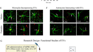 老化脳の炎症を抑制し記憶を回復する新療法（New therapy is turning back the clock in aging brains）