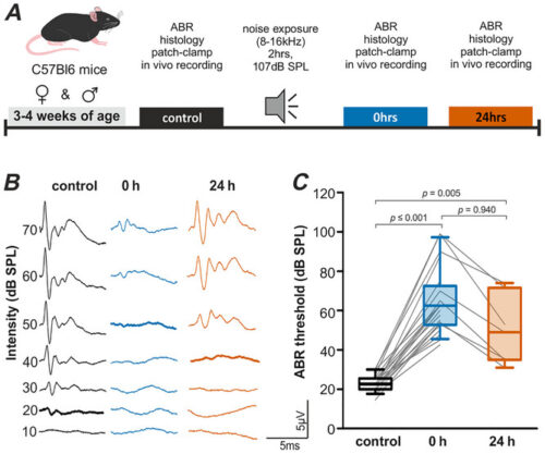 騒音による脳損傷からの回復メカニズムを解明(Neurophysiology: How the brain recovers from noise-induced damage) 騒音による脳損傷からの回復メカニズムを解明(Neurophysiology: How the brain recovers from noise-induced damage)