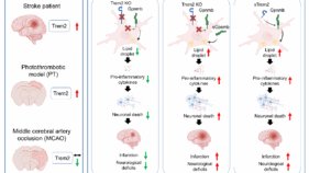 動物モデル選択の教訓：脳卒中後の神経炎症におけるTrem2の役割の解明（A Lesson in Animal Model Choice: Uncovering the Role of Trem2 in Post-Stroke Neuroinflammation）