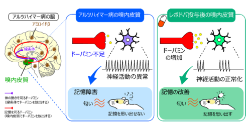 ドーパミン不足がアルツハイマー病の記憶障害を引き起こすことを発見－ドーパミンを用いた新たな治療法の開発を目指す－