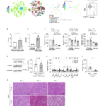 加齢・肥満に伴る心不全発生の新たな原因物質を特定 ― 褐色脂肪由来PCPE-1が心臓線維化を促進 ―