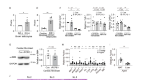 加齢・肥満に伴る心不全発生の新たな原因物質を特定 ― 褐色脂肪由来PCPE-1が心臓線維化を促進 ―