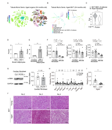 加齢・肥満に伴る心不全発生の新たな原因物質を特定 ― 褐色脂肪由来PCPE-1が心臓線維化を促進 ―