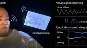 柔らかい皮膚型鼻パッチで睡眠モニタリングを変革へ（Soft, Skin-Like Nasal Patch Could Transform Sleep Monitoring）