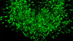 GLP-1系体重減少効果を増強する経路を発見 （NIH researchers identify avenue for enhanced GLP-1-induced weight loss）