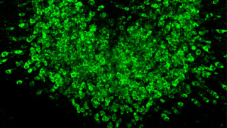 GLP-1系体重減少効果を増強する経路を発見 （NIH researchers identify avenue for enhanced GLP-1-induced weight loss）