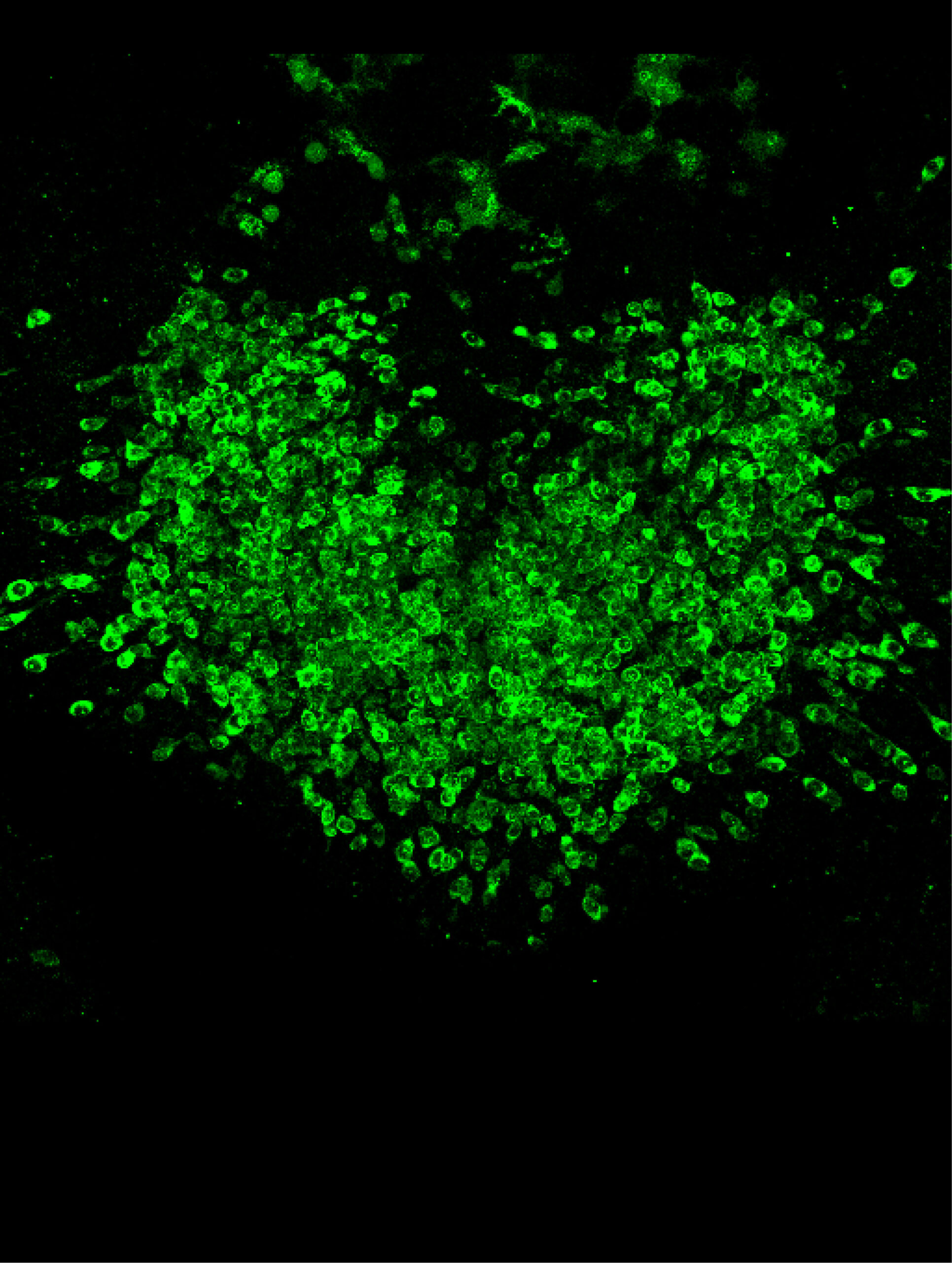 GLP-1系体重減少効果を増強する経路を発見 （NIH researchers identify avenue for enhanced GLP-1-induced weight loss）