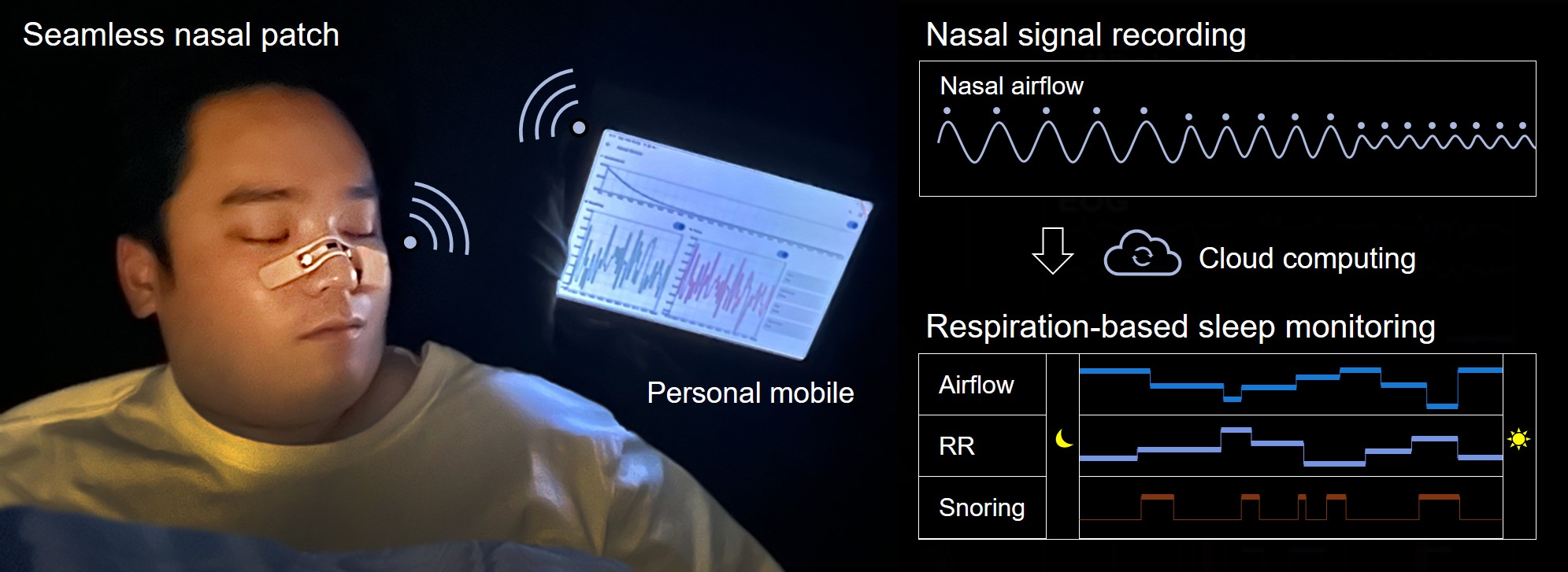 柔らかい皮膚型鼻パッチで睡眠モニタリングを変革へ（Soft, Skin-Like Nasal Patch Could Transform Sleep Monitoring）