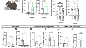 顔と身体で異なるかゆみ知覚メカニズムの解明（Why face itch differs from body）