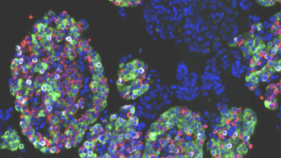 ヒト膵島細胞マップを作成、糖尿病リスク解明へ新知見 （NIH-funded study maps human pancreatic islet cells, offering new clues to diabetes risk）