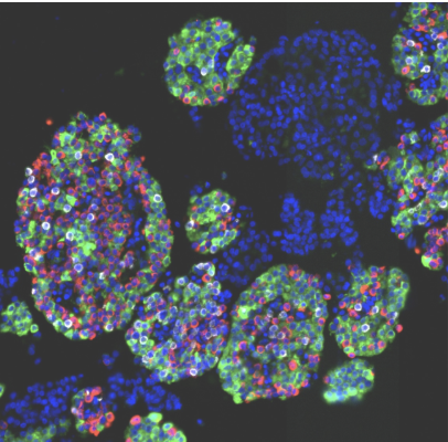 ヒト膵島細胞マップを作成、糖尿病リスク解明へ新知見 （NIH-funded study maps human pancreatic islet cells, offering new clues to diabetes risk）