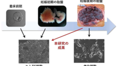 妊娠後期の胎盤からヒト胎盤幹細胞を作製する新技術を開発～妊娠高血圧腎症の原因解明と治療法開発への応用に期待～