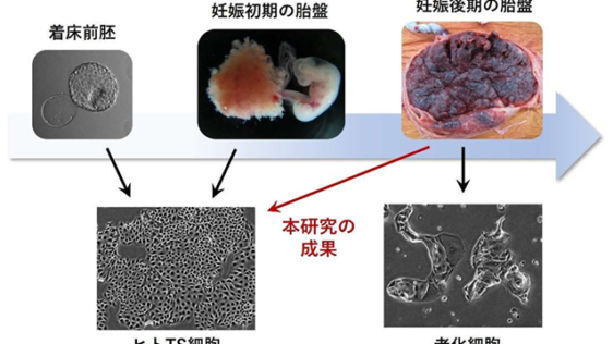 妊娠後期の胎盤からヒト胎盤幹細胞を作製する新技術を開発～妊娠高血圧腎症の原因解明と治療法開発への応用に期待～