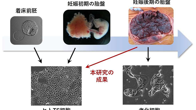 妊娠後期の胎盤からヒト胎盤幹細胞を作製する新技術を開発～妊娠高血圧腎症の原因解明と治療法開発への応用に期待～