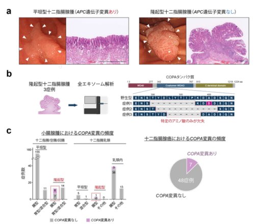 未知の小腸がん遺伝子「COPA」を発見 －新たな発がん経路を解明－