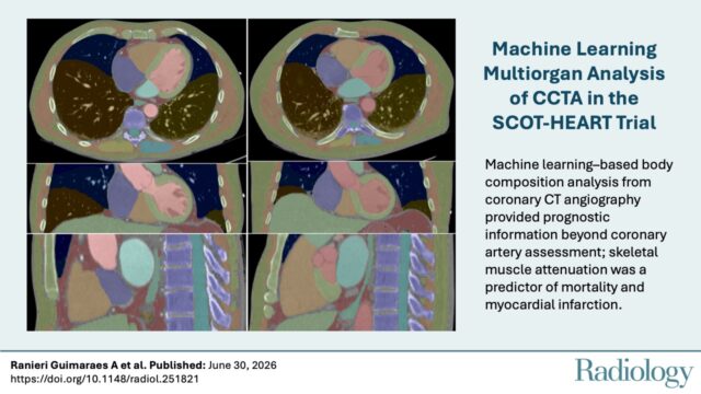 体幹筋力が心筋梗塞リスク低下と関連（Strong torso muscles linked to lower heart attack risk）