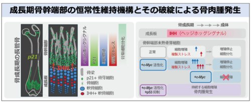 骨肉腫が思春期のひざ近傍に発生しやすい理由を解明   ――成長期における骨芽細胞の増殖活性化とDNA損傷応答の破綻により骨肉腫が発生することを発見――