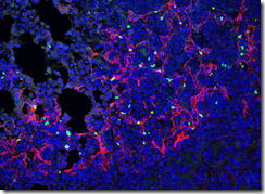肺がんを守る未知の細胞タイプを発見（Scientists Uncover Hidden Cell Type That Shields Lung Cancer）