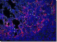 肺がんを守る未知の細胞タイプを発見（Scientists Uncover Hidden Cell Type That Shields Lung Cancer）