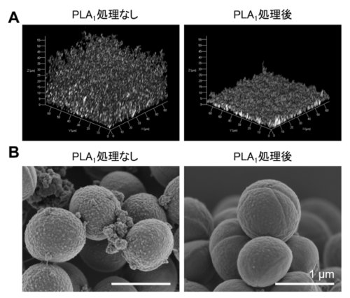 世界初、細菌感染を支える「分子の接着剤」を発見 ―細胞外リン脂質がバイオフィルムを組み立てる新しい仕組みを解明―